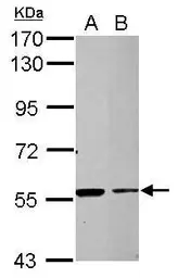 Anti-TRIM27 antibody used in Western Blot (WB). GTX107805