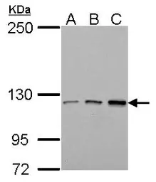 Anti-TIE1 antibody used in Western Blot (WB). GTX107818