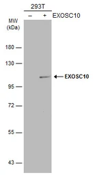Anti-EXOSC10 antibody used in Western Blot (WB). GTX107856