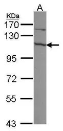 Anti-EXOSC10 antibody used in Western Blot (WB). GTX107856