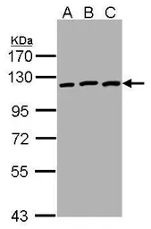 Anti-EphB3 antibody [C1C3] used in Western Blot (WB). GTX107882
