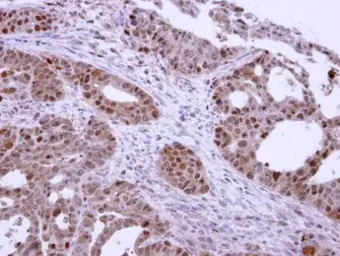 Anti-Casein Kinase 2 alpha antibody used in IHC (Paraffin sections) (IHC-P). GTX107897