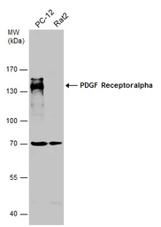 Anti-PDGF Receptor alpha antibody [N2C2], Internal used in Western Blot (WB). GTX107903