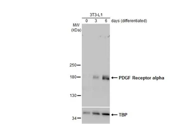 Anti-PDGF Receptor alpha antibody [N2C2], Internal used in Western Blot (WB). GTX107903