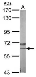 Anti-NLK antibody [N3C3] used in Western Blot (WB). GTX107910