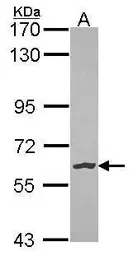 Anti-NLK antibody [N3C3] used in Western Blot (WB). GTX107910