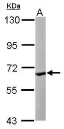 Anti-COASY antibody [N3C3-3] used in Western Blot (WB). GTX107934