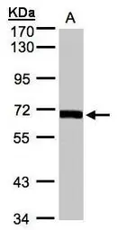Anti-COASY antibody [N3C3-3] used in Western Blot (WB). GTX107934