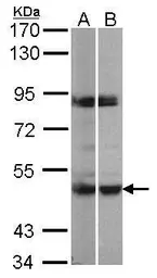Anti-PRAK antibody [N3C3] used in Western Blot (WB). GTX107938