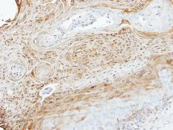 Anti-MEKK3 antibody [N3C3] used in IHC (Paraffin sections) (IHC-P). GTX107945