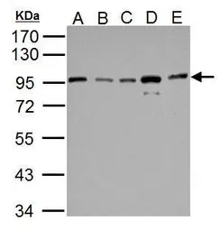 Anti-IKK beta antibody used in Western Blot (WB). GTX107970