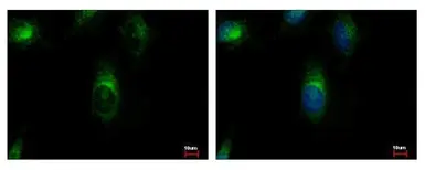 Anti-ARFGAP3 antibody [C3], C-term used in Immunocytochemistry/ Immunofluorescence (ICC/IF). GTX107999
