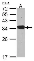 Anti-Protease Inhibitor 15 antibody [C2C3], C-term used in Western Blot (WB). GTX108006