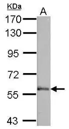 Anti-VAM1 antibody [N1], N-term used in Western Blot (WB). GTX108010