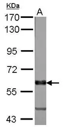 Anti-VAM1 antibody [N1], N-term used in Western Blot (WB). GTX108010