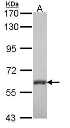 Anti-VAM1 antibody [N1], N-term used in Western Blot (WB). GTX108010