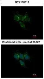 Anti-GSTA1 antibody used in Immunocytochemistry/ Immunofluorescence (ICC/IF). GTX108012