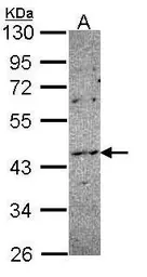 Anti-NOXO1 antibody [C2C3], C-term used in Western Blot (WB). GTX108043