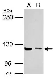 Anti-Munc 13-4 antibody [C3], C-term used in Western Blot (WB). GTX108105