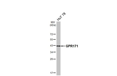 Anti-GPR171 antibody [N1], N-term used in Western Blot (WB). GTX108131