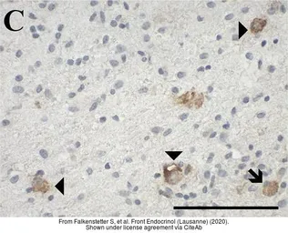 Anti-GALR3 antibody used in IHC (Paraffin sections) (IHC-P). GTX108163