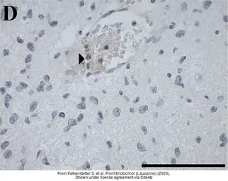 Anti-GALR3 antibody used in IHC (Paraffin sections) (IHC-P). GTX108163