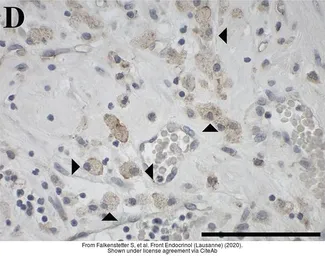 Anti-GALR3 antibody used in IHC (Paraffin sections) (IHC-P). GTX108163