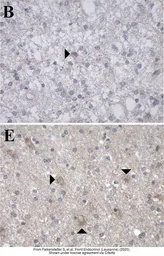 Anti-GALR1 antibody [C2C3], C-term used in IHC (Paraffin sections) (IHC-P). GTX108207