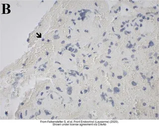 Anti-GALR1 antibody [C2C3], C-term used in IHC (Paraffin sections) (IHC-P). GTX108207