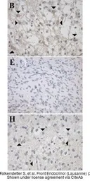 Anti-GALR1 antibody [C2C3], C-term used in IHC (Paraffin sections) (IHC-P). GTX108207