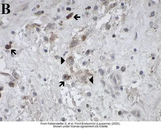 Anti-GALR1 antibody [C2C3], C-term used in IHC (Paraffin sections) (IHC-P). GTX108207