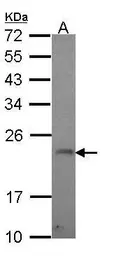 Anti-GADD45G antibody [C1C3] used in Western Blot (WB). GTX108257
