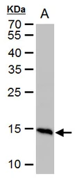 Anti-Histone H2A.X antibody used in Western Blot (WB). GTX108272