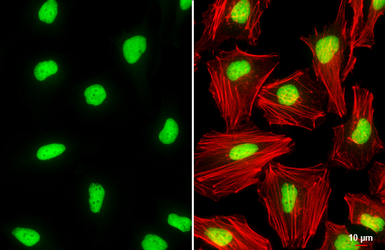 Anti-Histone H2A.X antibody used in Immunocytochemistry/ Immunofluorescence (ICC/IF). GTX108272