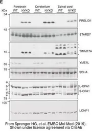 Anti-TIM17 antibody [C1C3] used in Western Blot (WB). GTX108280