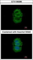 Anti-alpha TTP antibody [C2C3], C-term used in Immunocytochemistry/ Immunofluorescence (ICC/IF). GTX108286