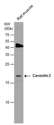 Anti-Caveolin 2 antibody used in Western Blot (WB). GTX108294