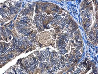 Anti-CaMKK beta antibody used in IHC (Paraffin sections) (IHC-P). GTX108305