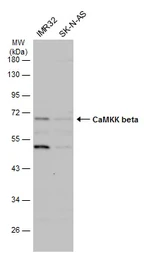 Anti-CaMKK beta antibody used in Western Blot (WB). GTX108305