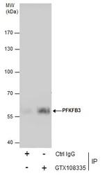 Anti-PFKFB3 antibody [C3], C-term used in Immunoprecipitation (IP). GTX108335