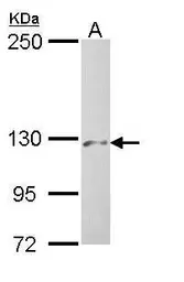 Anti-PHKA2 antibody [C3], C-term used in Western Blot (WB). GTX108342