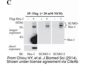 Anti-HES1 antibody [N1], N-term used in Western Blot (WB). GTX108356