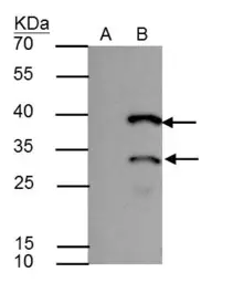 Anti-HES1 antibody [N1], N-term used in Immunoprecipitation (IP). GTX108356