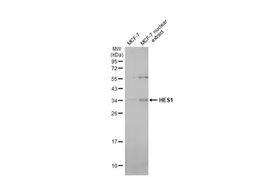 Anti-HES1 antibody [N1], N-term used in Western Blot (WB). GTX108356