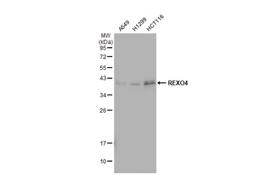 Anti-REXO4 antibody [C3], C-term used in Western Blot (WB). GTX108364
