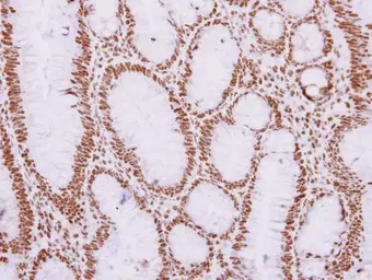 Anti-REXO4 antibody [C3], C-term used in IHC (Paraffin sections) (IHC-P). GTX108364