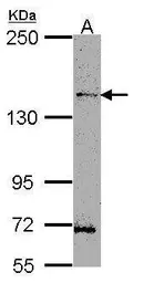 Anti-HIPK3 antibody [C3], C-term used in Western Blot (WB). GTX108369