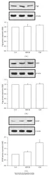 Anti-P Glycoprotein antibody used in Western Blot (WB). GTX108370