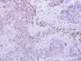 Anti-I-309 antibody used in IHC (Paraffin sections) (IHC-P). GTX108412