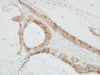 Anti-CMTM6 antibody [C1C3] used in IHC (Paraffin sections) (IHC-P). GTX108450